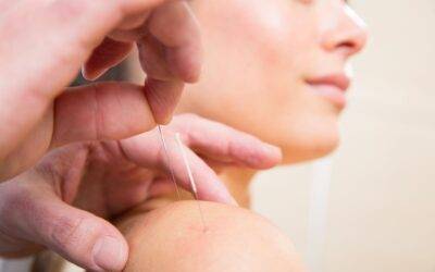 Understanding Traditional Chinese Acupuncture