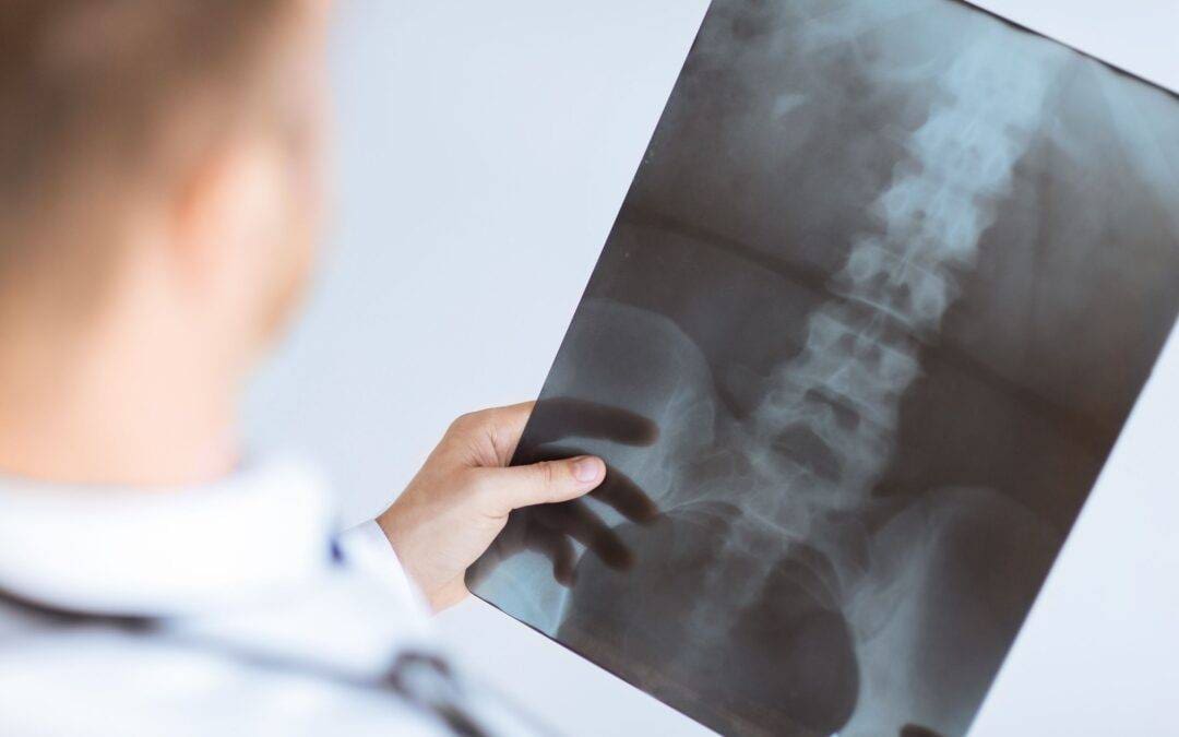 close up of male doctor holding x-ray or roentgen image